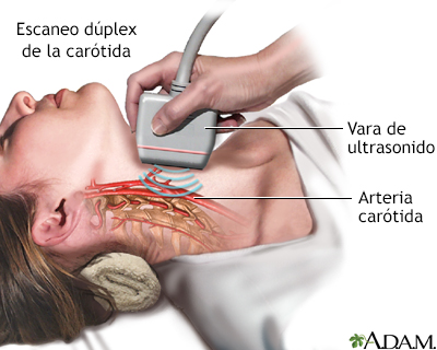 Doppler de Vasos del Cuello ($ARS)