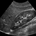 Ecografía Abdominal ($ARS)