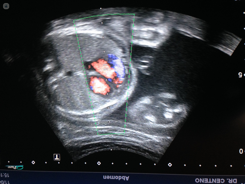 Ecocardiograma Fetal