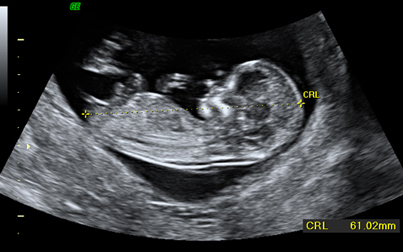 Curso de Ecografía y Medicina Fetal: Ecografía Obstétrica, Doppler Obstétrico, Ecocardiografía Fetal (Modalidad de cursado regular, no intensivo) y Genética
