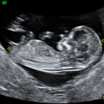 Curso de Ecografía y Medicina Fetal: Ecografía Obstétrica, Doppler Obstétrico, Ecocardiografía Fetal (Modalidad de cursado regular, no intensivo) y Genética ($ARS)